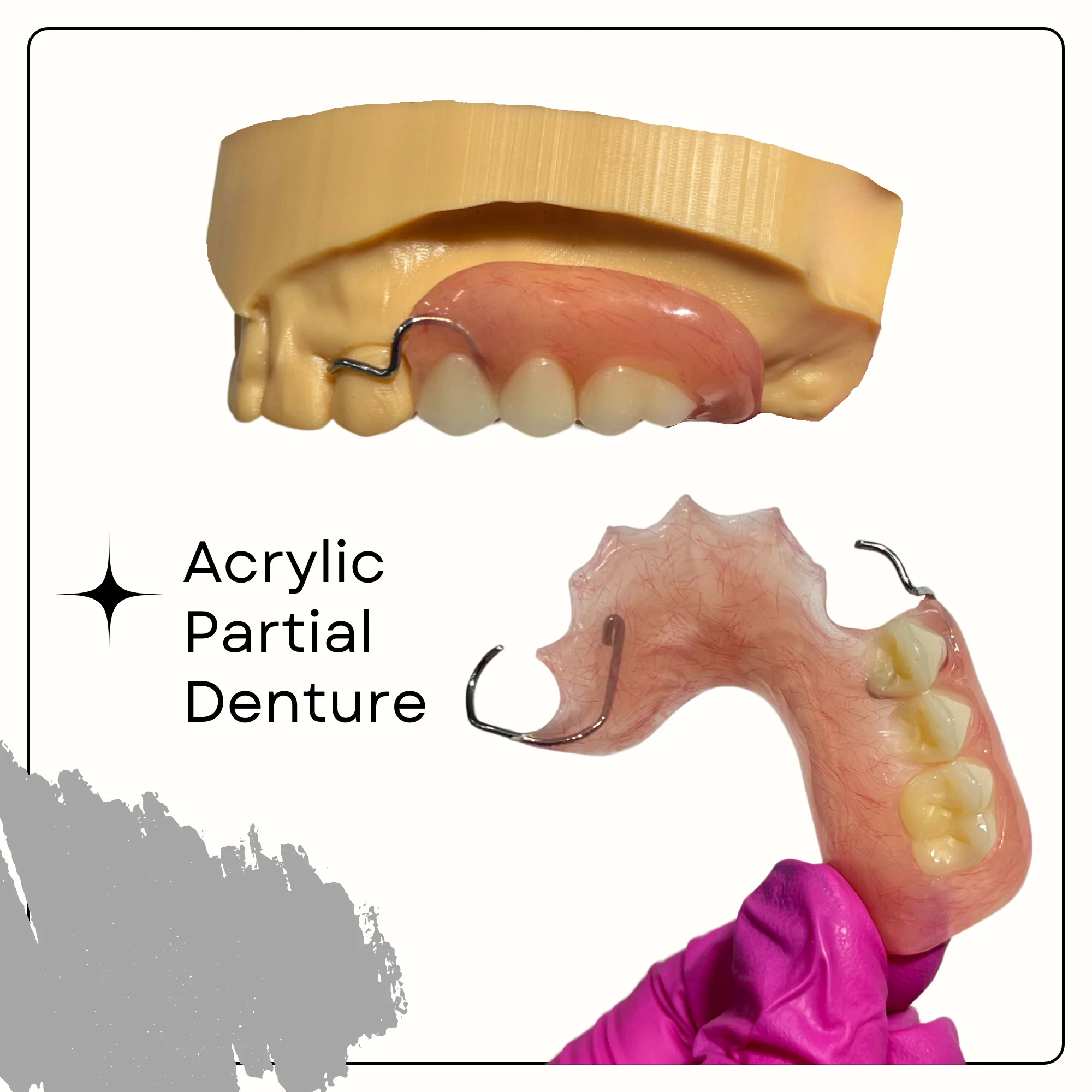 Dentures