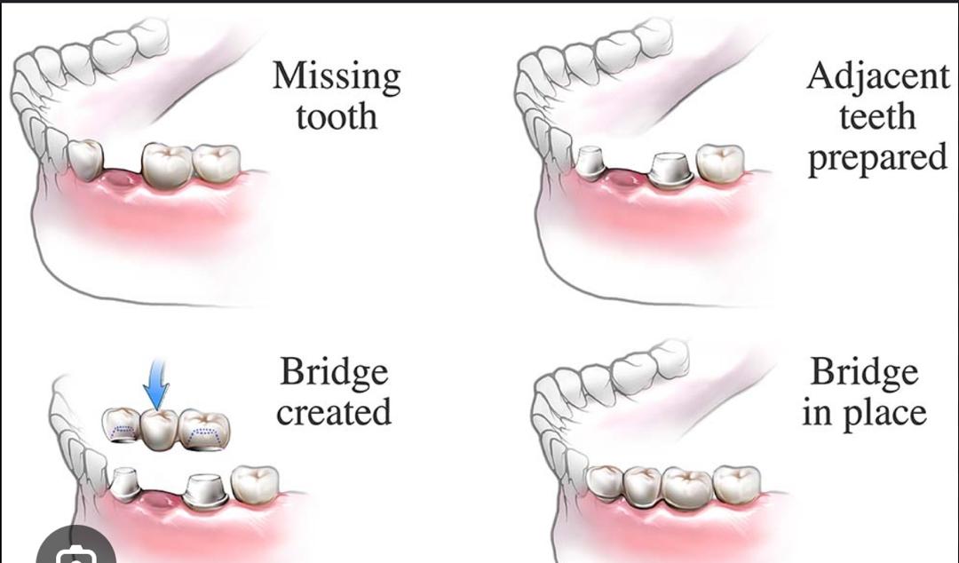 Restorative Dentistry