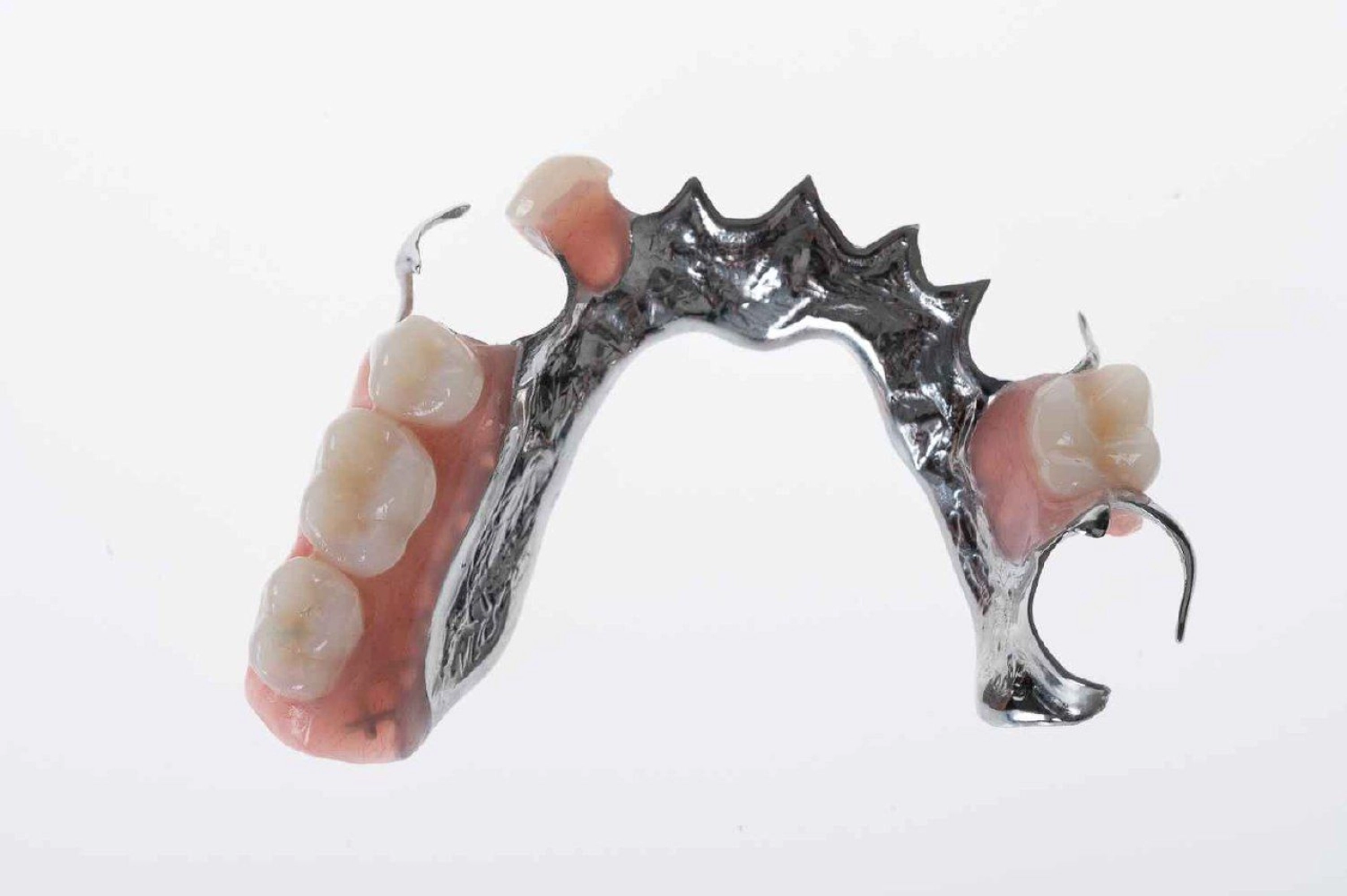 Dentures Example 2
